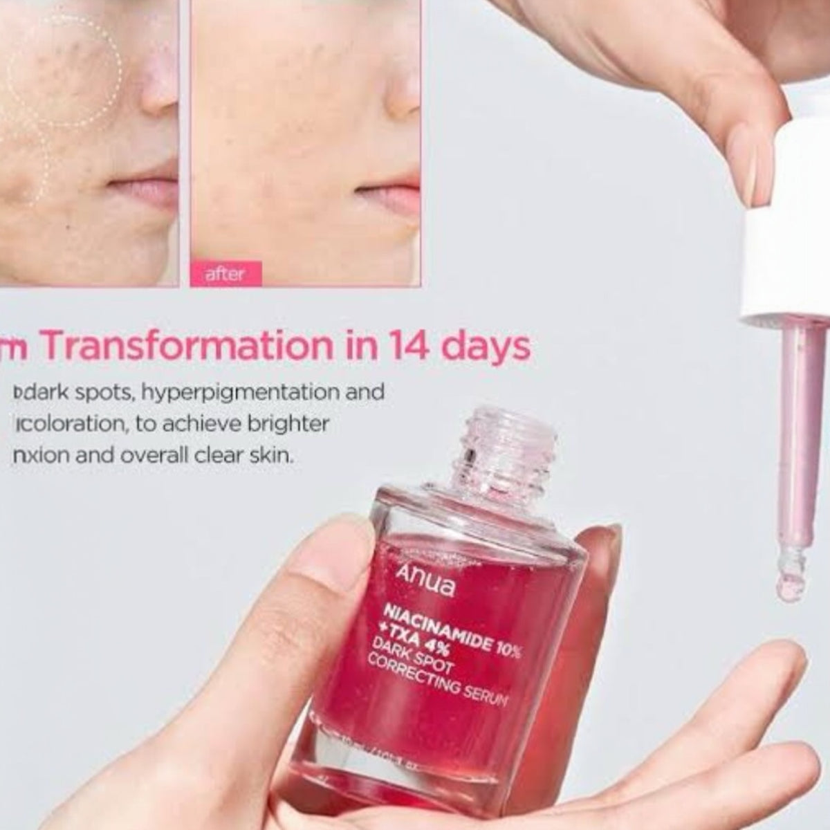 Anua Niacinamide 10% Dark Sport Correcting Serum