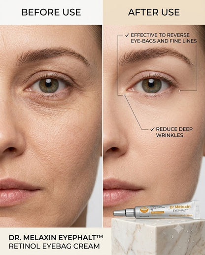 Dr Melaxin eyephalt ep ( retinol eyebag cream )