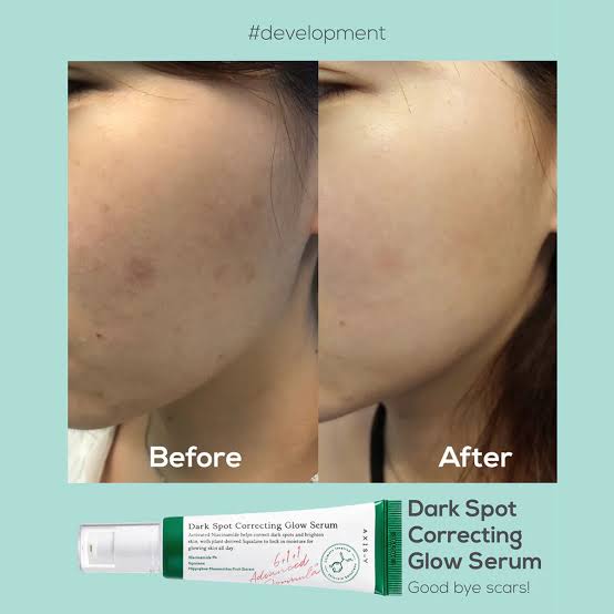 Axis-Y Face Dark Sport Serum
